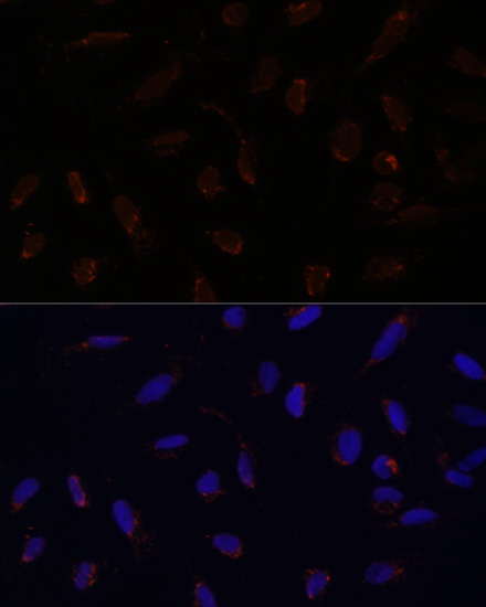 ACAT1 Antibody