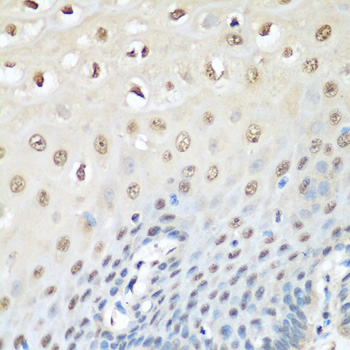 VCP antibody