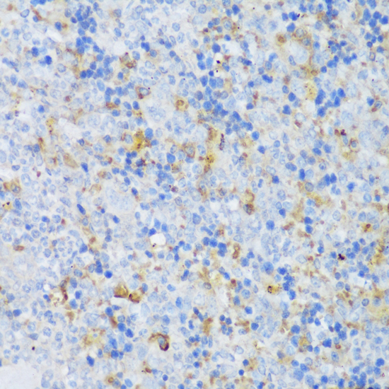 CRACR2A Polyclonal Antibody