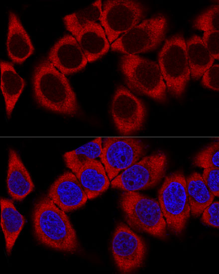 RPL36AL Polyclonal Antibody