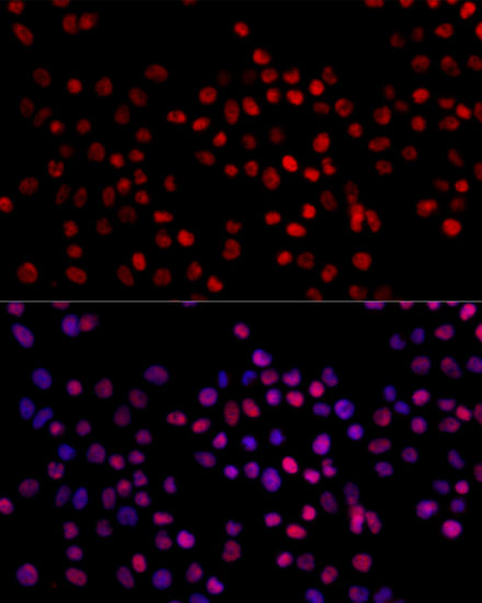 XRCC4 Antibody