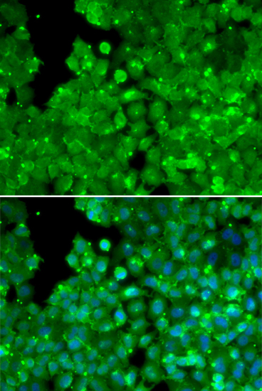 IL10RA antibody