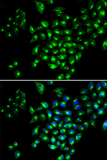 RUNX1 Antibody