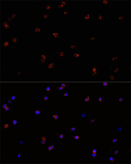 PTPRC Antibody