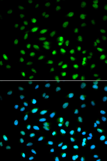 STK11 Antibody