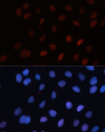 SUMO1 Antibody