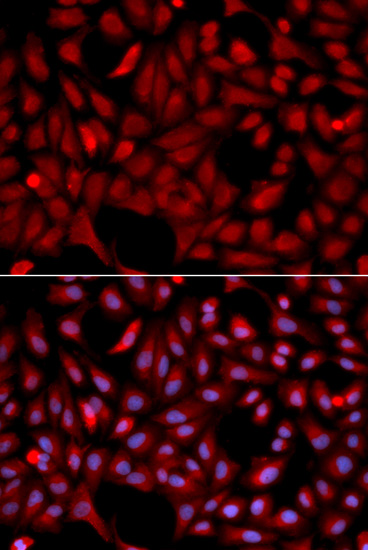 SIAH1 Antibody