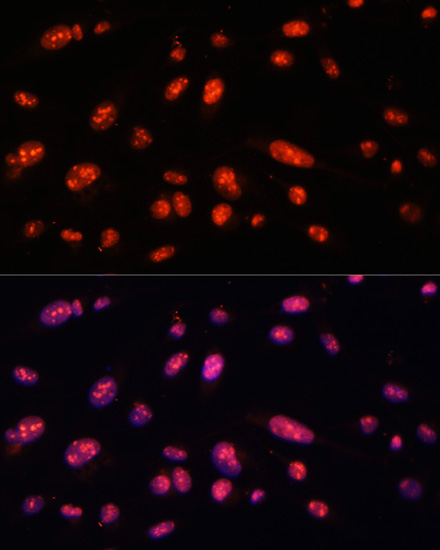 ILF3 antibody