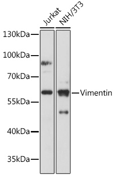 VIM Antibody