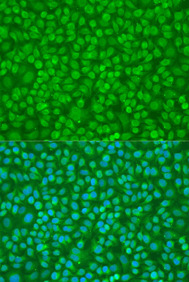 PTPN11 antibody