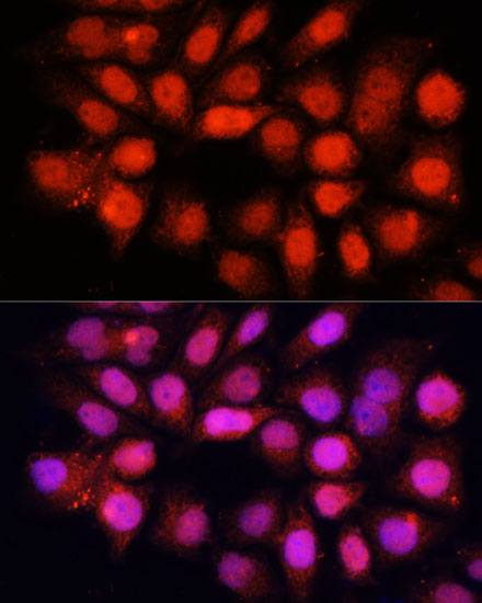 DDB1 antibody