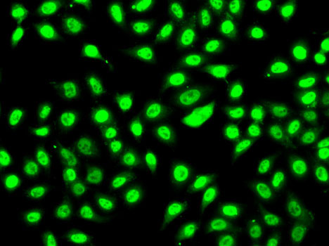 SF3B2 antibody