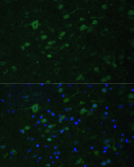 MLL5 antibody