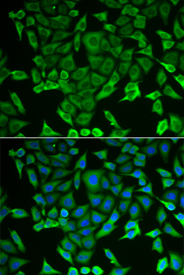 RARS antibody