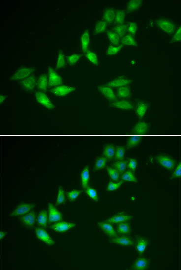 TXNL1 antibody