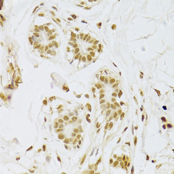 SNRPA antibody