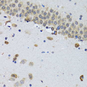 MMP10 Antibody