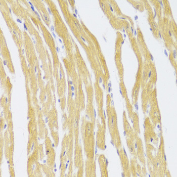 CSRP3 antibody