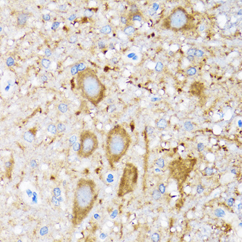 HSPH1 antibody