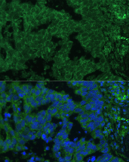 IL25 Polyclonal Antibody