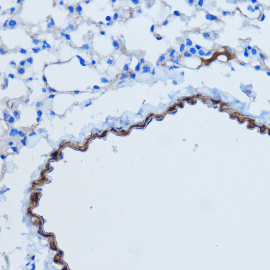 ACTA2 antibody