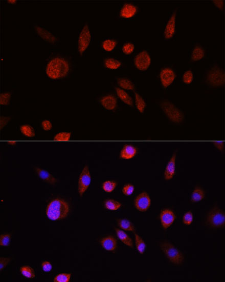 pan-AKT antibody