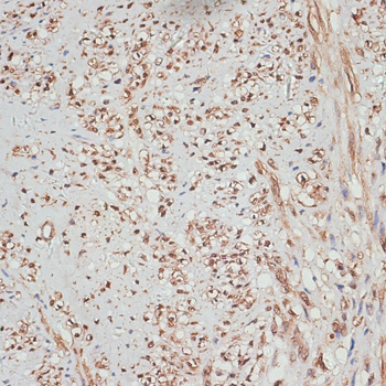 YAP1 Rabbit Polyclonal Antibody