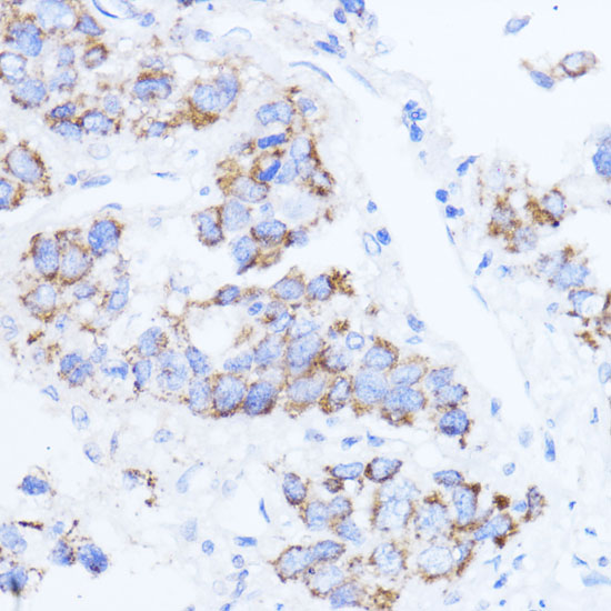 ACAT1 Antibody