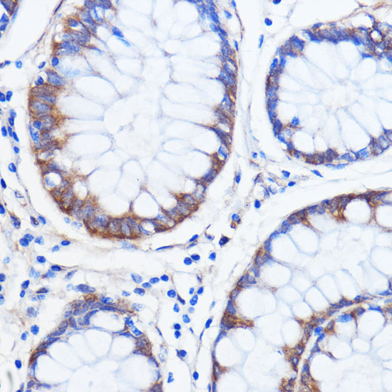 ATXN2 Polyclonal Antibody