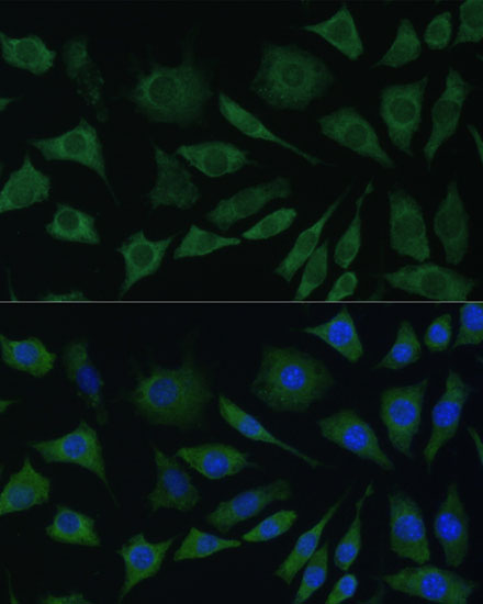 BMPR1B Antibody