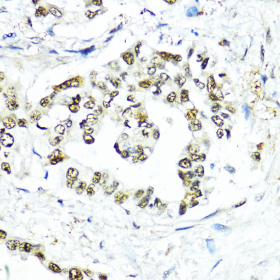 SUMO1 Antibody