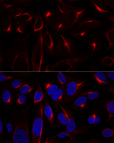 VIM Antibody