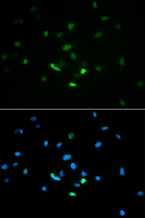 TP53 antibody