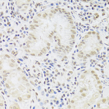 SNRPA antibody