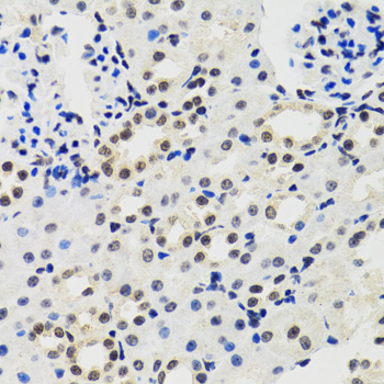 MMP10 Antibody