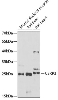 CSRP3 antibody