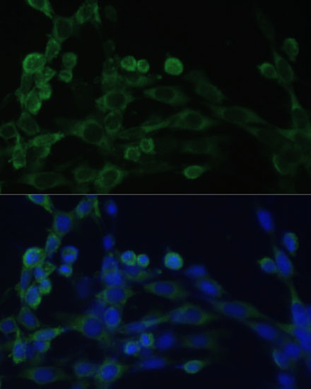 EEF1B2 antibody