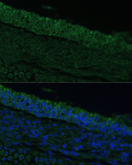 IL25 Polyclonal Antibody