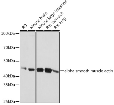 ACTA2 antibody