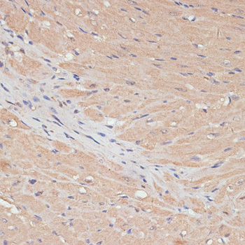 YAP1 Rabbit Polyclonal Antibody