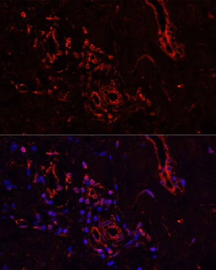 COL1A1 Polyclonal Antibody