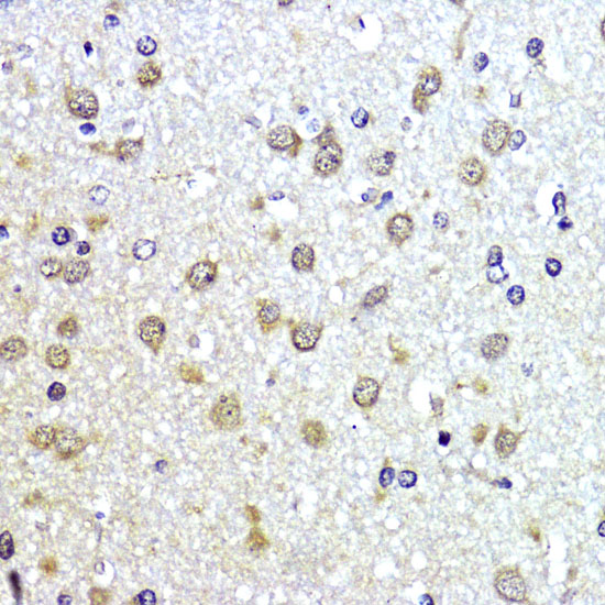 SUMO1 Antibody