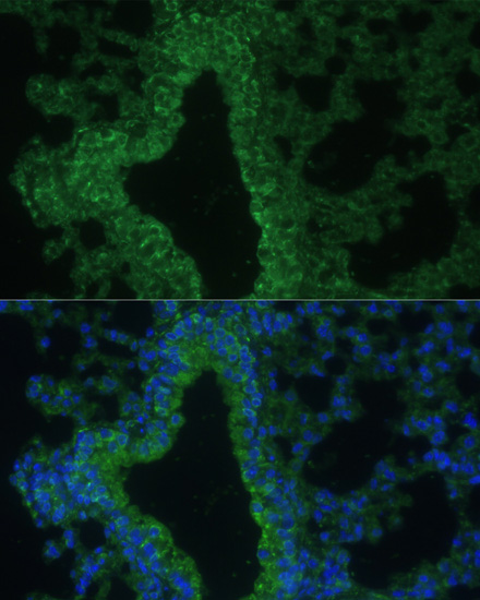 IL25 Polyclonal Antibody