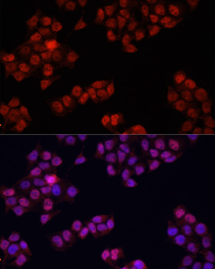 YAP1 Rabbit Polyclonal Antibody