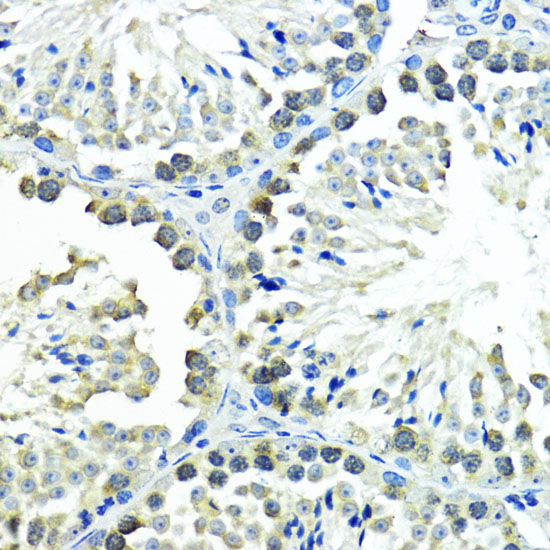 SUMO1 Antibody