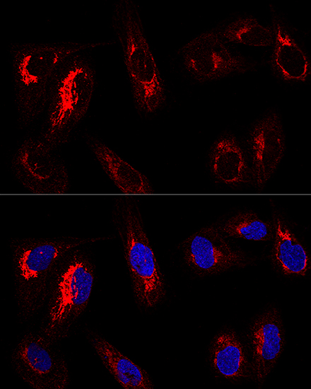 AIFM1 Antibody