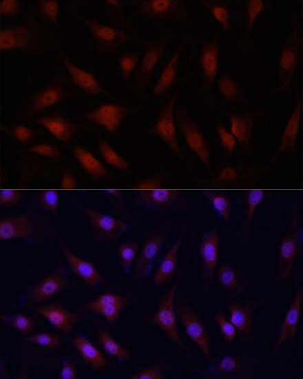 YAP1 Rabbit Polyclonal Antibody