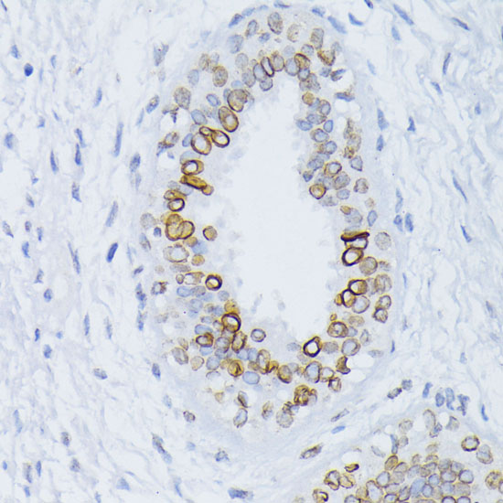 LMNB1 Antibody