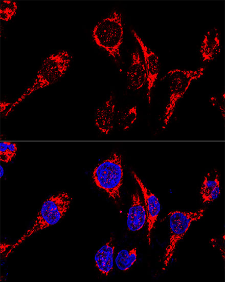 AIFM1 Antibody