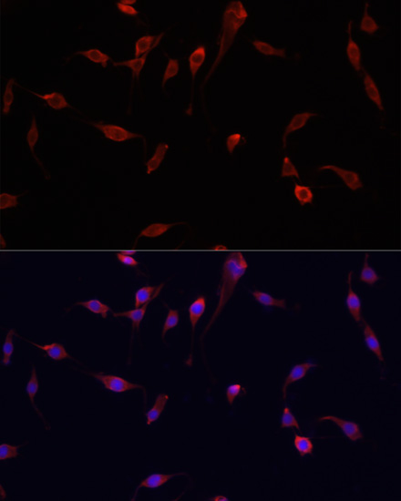 YAP1 Rabbit Polyclonal Antibody